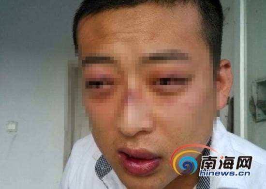 三亞一大學生稱晚歸遭保安毆打 學校稱沒這事